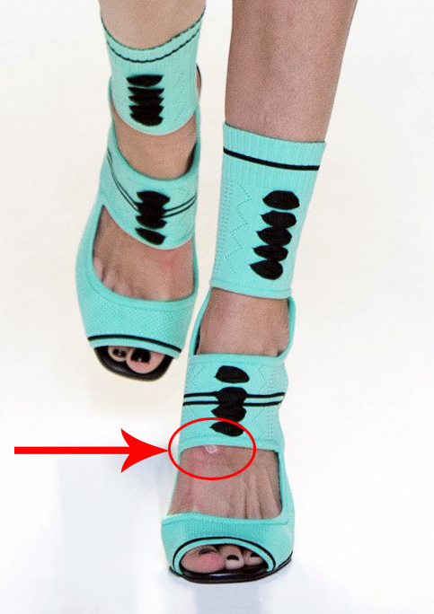 Джиджи Хадид натерла ногу босоножками-носками Fendi?