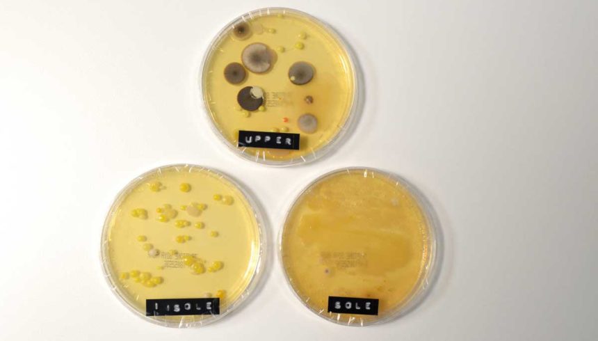 Бактерии из кед, которые носили с носками