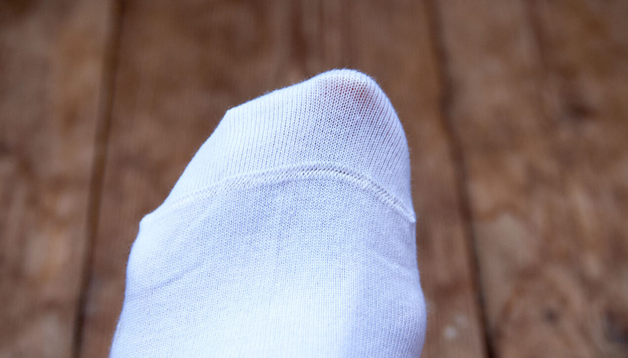 Что такое hand-linking toe и почему это важно для ваших ног