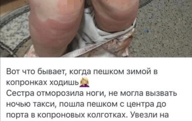 «Вот что бывает, когда пешком зимой в капронках ходишь»: девушка обморозила ноги из-за тонких колготок