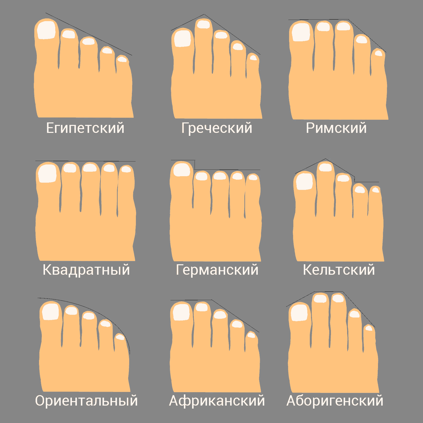 Инфографика: 9 видов стоп в зависимости от формы, которую образуют пальцы.