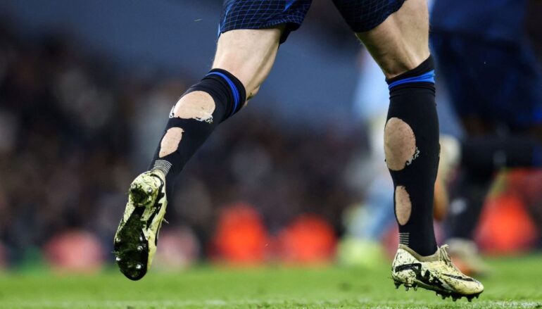 Премьер-лигу Англии призвали запретить футболистам вырезать дырки в носках